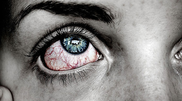 Zalety kropli do oczu bez konserwantów