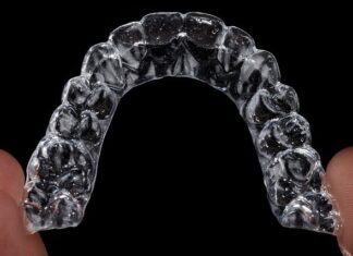 Po jakim czasie widać efekty Invisalign?